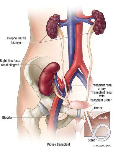 Kidney Specialist in Pune