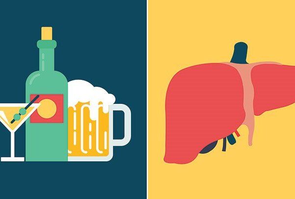 The Stages Of Alcoholic Liver Disease And How it's Treated