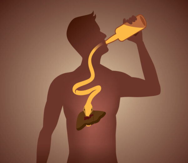 Alcohol and Liver Health
