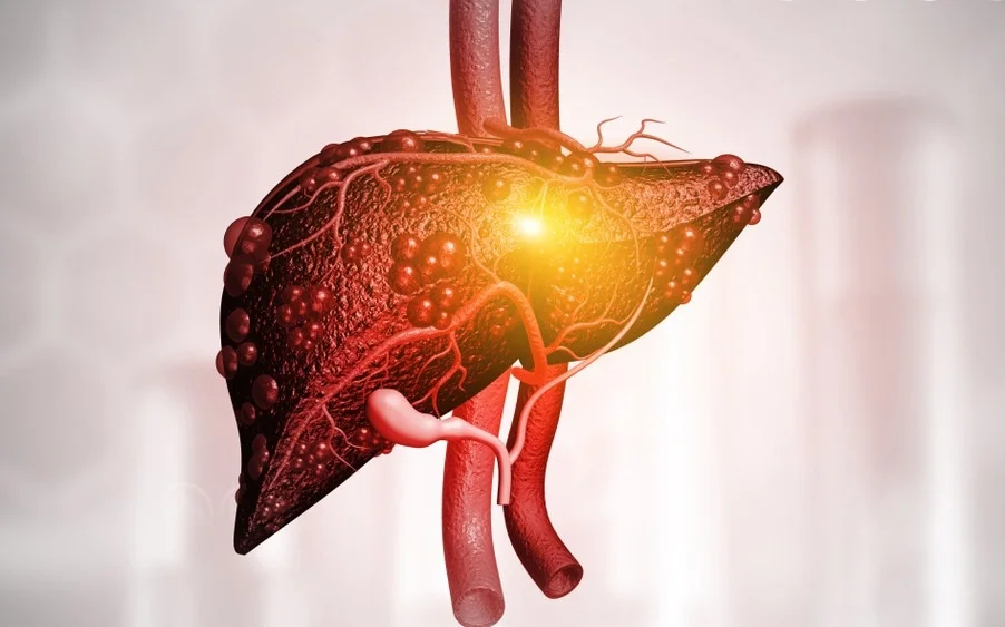 The Silent Threat: Liver Diseases with No Symptoms | Dr. Ninad Deshmukh